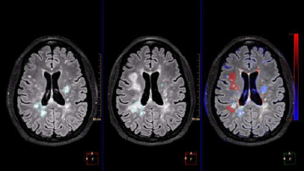 5-3MLinHealthcare-2