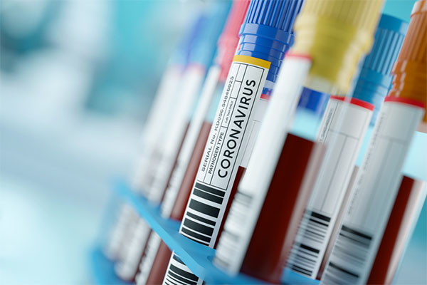 Coronavirus 2019-nCoV Blood Samples Medical Concept Private Industry, Accademia Stepping Up in AI Fight Against Covid-19 1