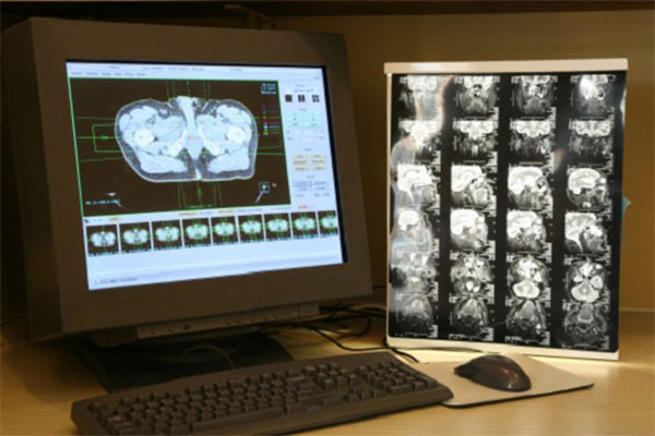 Intel, Penn Medicine Launch Federated Learning Model For Brain Tumors 1