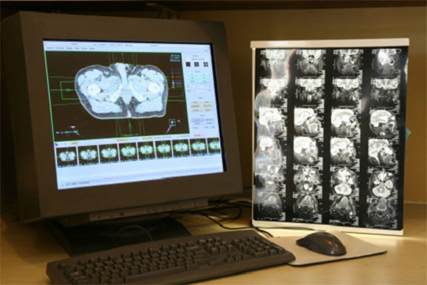 Data Medical Intel, Penn Medicine Launch Federated Learning Model For Brain Tumors 1