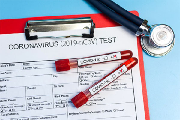 Pandemic COVID-19, Coronavirus. Nobody. Medical supplies on blue background