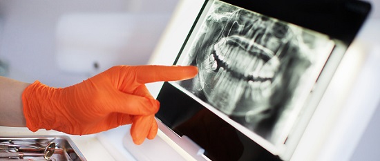 AI Making Some Headway into Diagnosis and Prognosis in Dentistry 